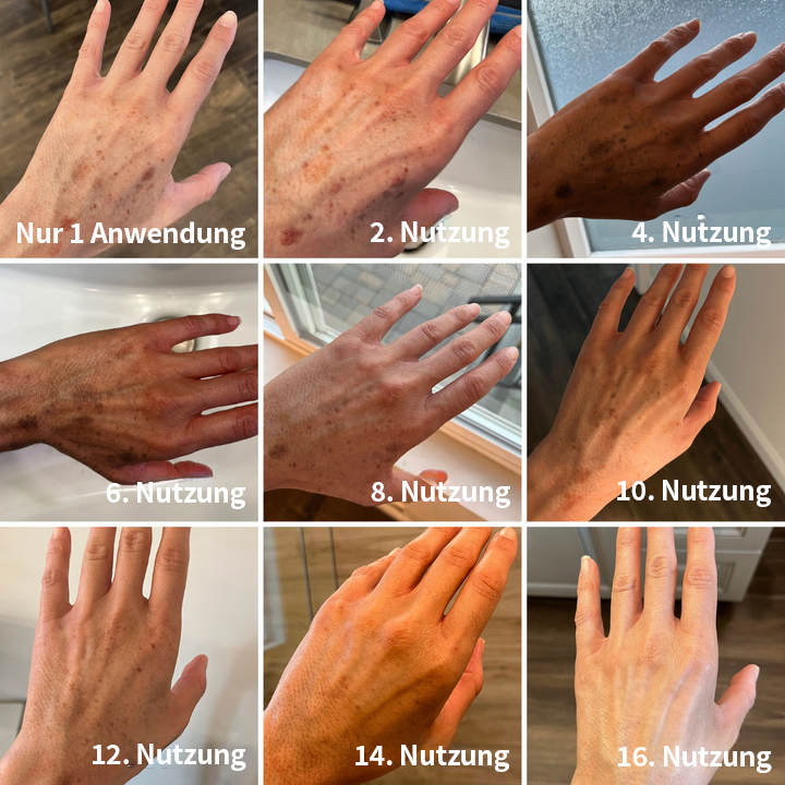 ⭐Last Day Sale-80% OFF) - LEFUN® Melanin korrigierende Creme