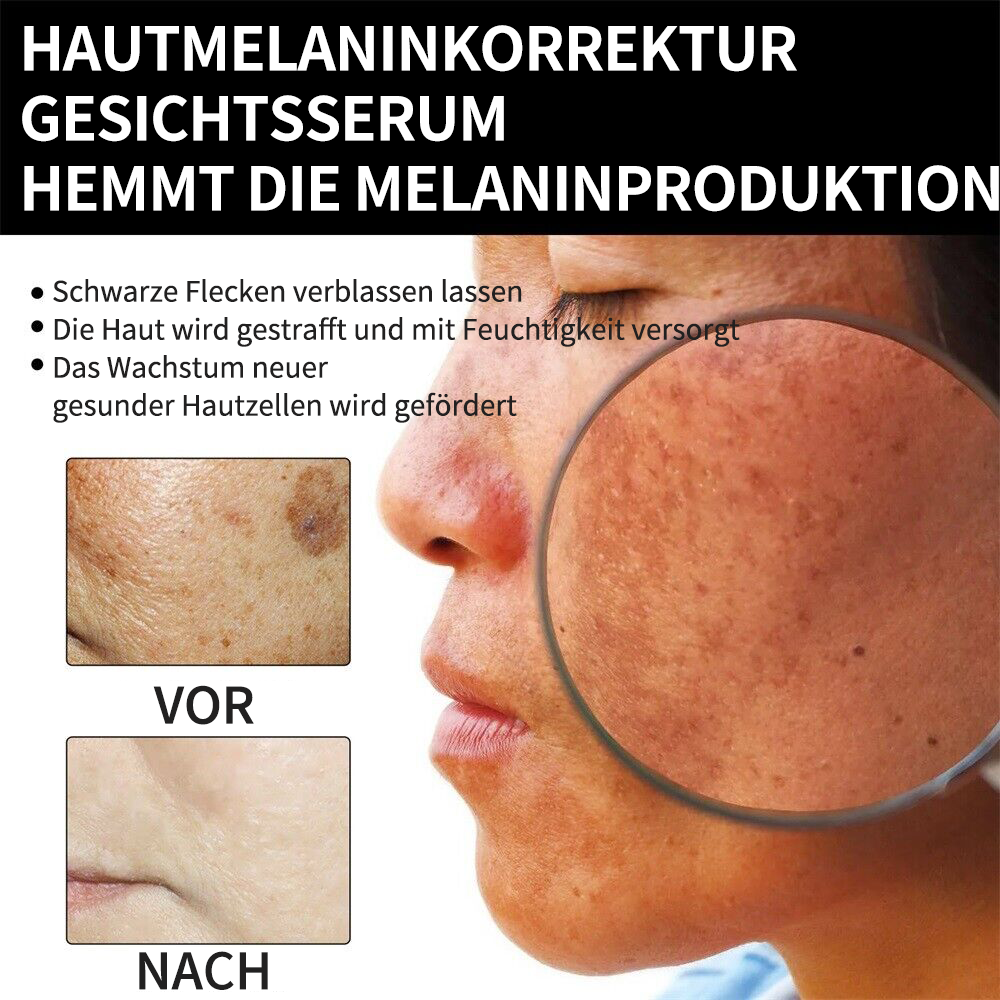 ⭐Last Day Sale-80% OFF) - LEFUN® Melanin korrigierende Creme