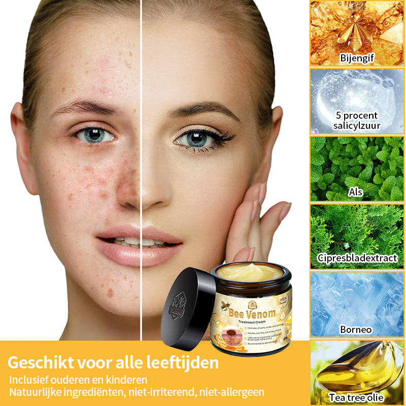 ⭐𝑇𝑢𝑟𝑜𝑛𝑢™ Bijengif Huidbehandelingscrème💌(aanbevolen door EMA)