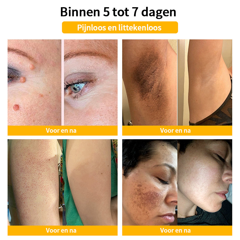 ⭐𝑇𝑢𝑟𝑜𝑛𝑢™ Bijengif Huidbehandelingscrème💌(aanbevolen door EMA)