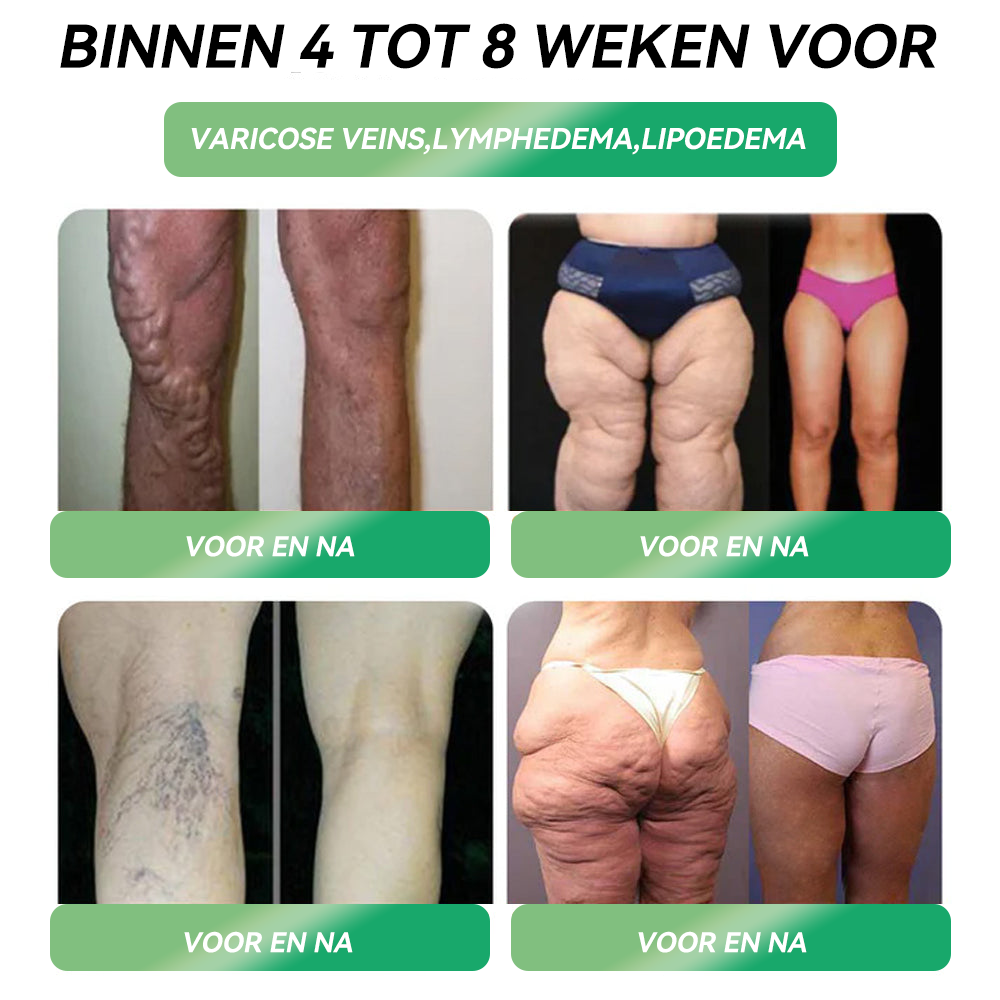 Tijdelijke korting: 70% korting | ššš«šššĀ® š¦šæš-1 Oral Solution Slechts ƩƩn keer per week, zichtbare veranderingen binnen 7 dagen ⨠Voor obesitas, hart- en vaatgezondheid, diabetes, slaapapneu, gewrichtsklachten en meerš