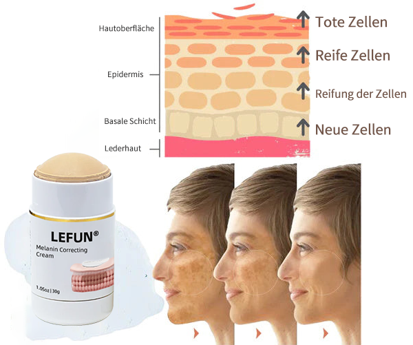 ⭐Last Day Sale-80% OFF) - LEFUN® Melanin korrigierende Creme