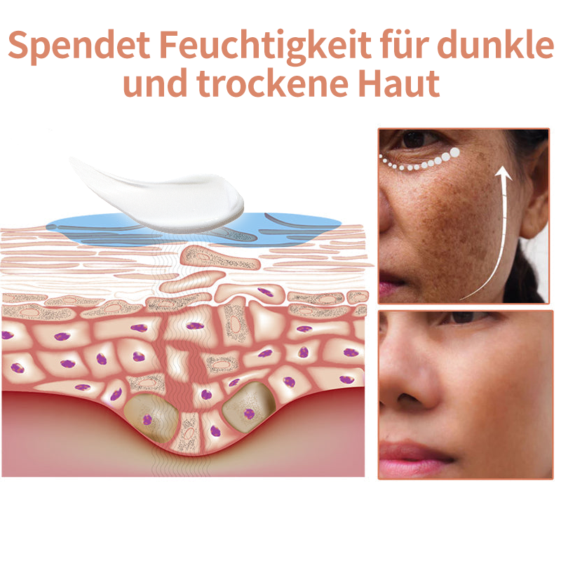 ⭐Last Day Sale-80% OFF) - LEFUN® Melanin korrigierende Creme