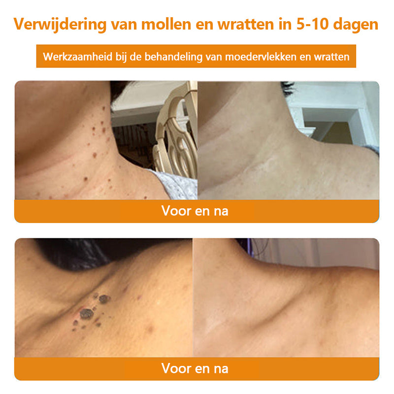 ⭐𝑇𝑢𝑟𝑜𝑛𝑢™ Bijengif Huidbehandelingscrème💌(aanbevolen door EMA)