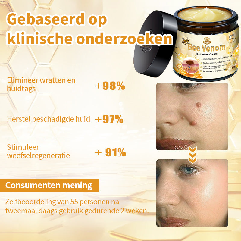 ⭐𝑇𝑢𝑟𝑜𝑛𝑢™ Bijengif Huidbehandelingscrème💌(aanbevolen door EMA)