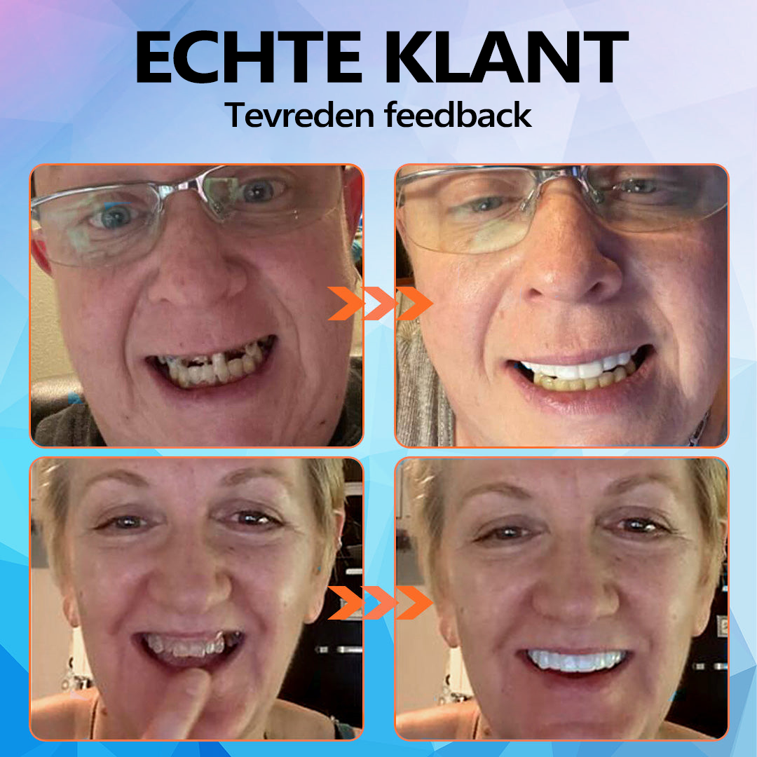 Een nieuw tijdperk van adaptieve kunstgebitten geopend👑Bikenda™ siliconen kunstgebitset (Laatste kortingstijd: 30 minuten)