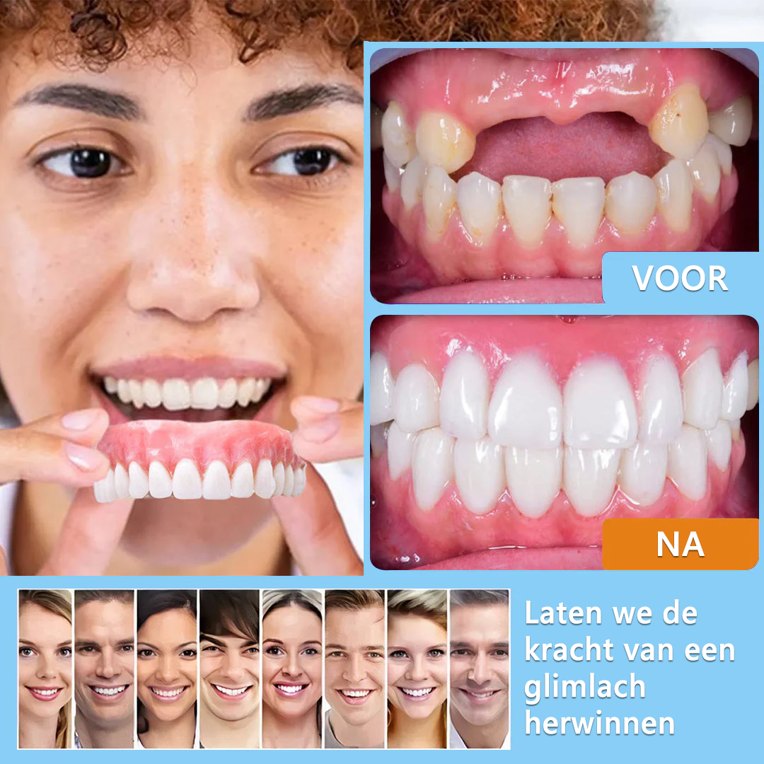 HEATWOLF® 💎Premium Geavanceerd Op Maat Gemaakt Volledig Kunstgebit Set💎 (⏰Tijdelijke korting, nog 30 minuten!)