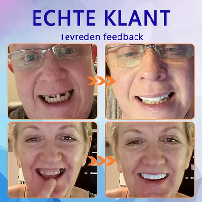 HEATWOLF® 💎Premium Geavanceerd Op Maat Gemaakt Volledig Kunstgebit Set💎 (⏰Tijdelijke korting, nog 30 minuten!)