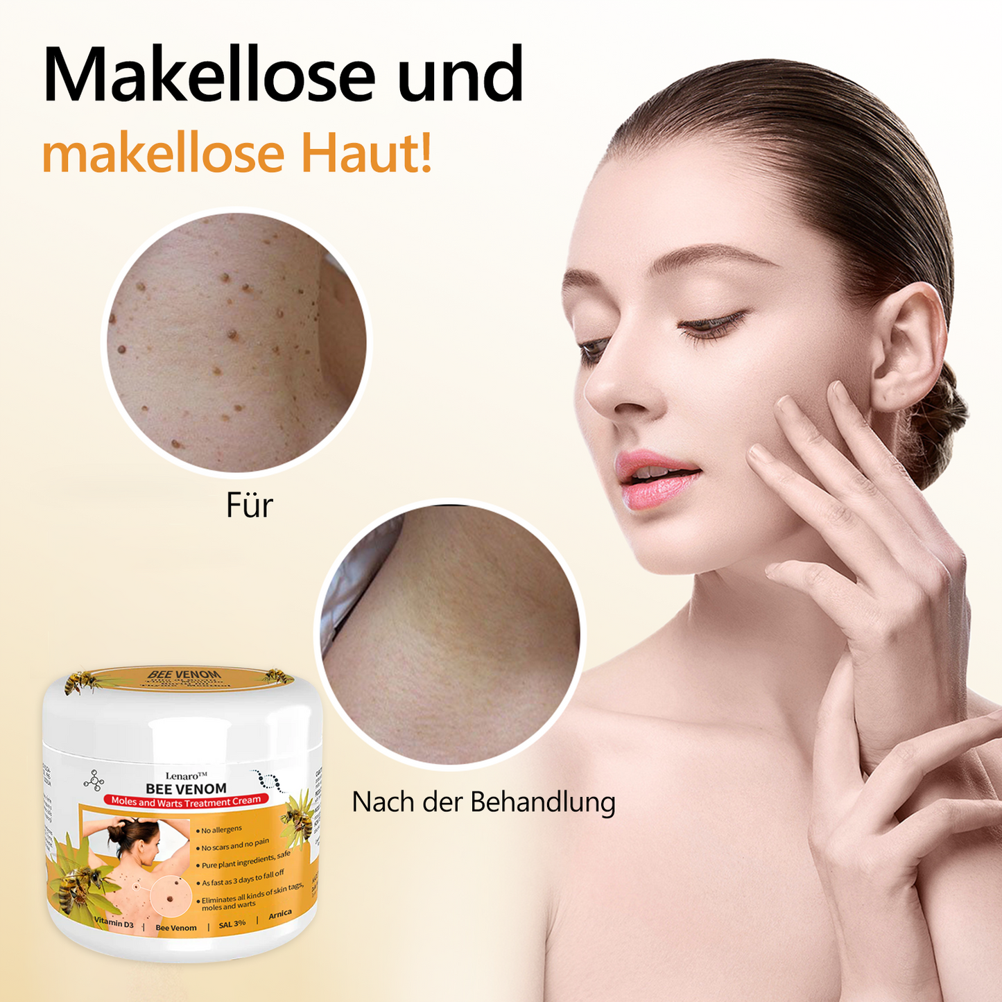 🐝🐝[👑Offizieller Markenshop👑] Lenaro™ Bienengift Maulwurf und Warze Behandlung Creme(👨‍⚕AAD EMPFIEHLT)