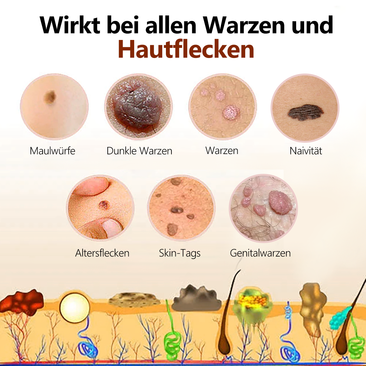 🐝🐝[👑Offizieller Markenshop👑] Lenaro™ Bienengift Maulwurf und Warze Behandlung Creme(👨‍⚕AAD EMPFIEHLT)