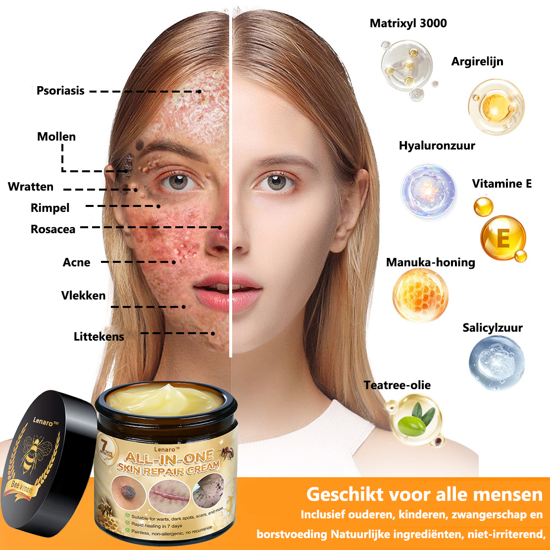 [Officiële merkwinkel] 💎 𝐋𝐞𝐧𝐚𝐫𝐨® Belgische Dermatologisch Gecertificeerde Bijengif Crème voor Alle Toepassingen （👩‍⚕️BSD Aanbevolen）