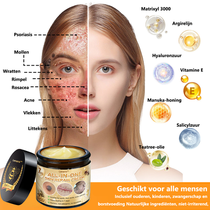 [Officiële merkwinkel] 💎 𝐋𝐞𝐧𝐚𝐫𝐨® Belgische Dermatologisch Gecertificeerde Bijengif Crème voor Alle Toepassingen （👩‍⚕️BSD Aanbevolen）