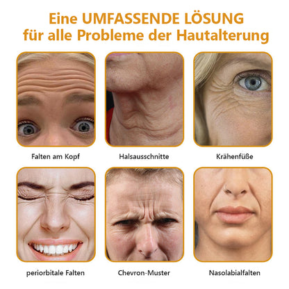 Hergestellt und versendet aus Deutschland✅ Lenaro™ Botox Bienengift Faltencreme - Letzter Tag 80% Rabatt👨‍⚕️
