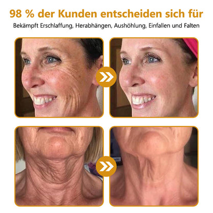 Hergestellt und versendet aus Deutschland✅ Lenaro™ Botox Bienengift Faltencreme - Letzter Tag 80% Rabatt👨‍⚕️