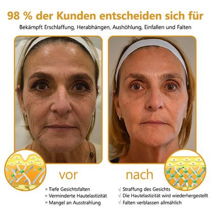 Hergestellt und versendet aus Deutschland✅ Lenaro™ Botox Bienengift Faltencreme - Letzter Tag 80% Rabatt👨‍⚕️
