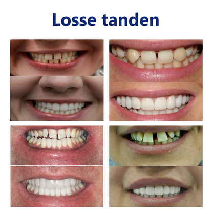 𝐵𝑖𝑘𝑒𝑛𝑑𝑎™ Silicium Prothese Meetset 👩‍🔬 Erkend door de Nederlandse Vereniging voor Tandheelkunde en goedgekeurd door de MDR）