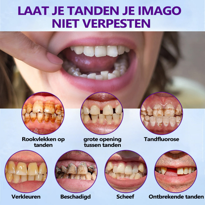 𝐵𝑖𝑘𝑒𝑛𝑑𝑎™ Silicium Prothese Meetset 👩‍🔬 Erkend door de Nederlandse Vereniging voor Tandheelkunde en goedgekeurd door de MDR）