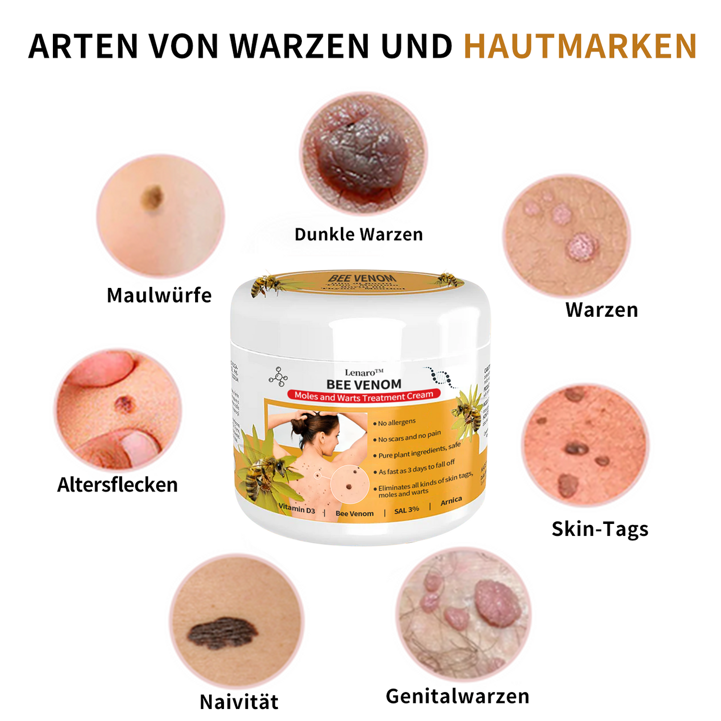 🐝🐝[👑Offizieller Markenshop👑] Lenaro™ Bienengift Maulwurf und Warze Behandlung Creme(👨‍⚕AAD EMPFIEHLT)