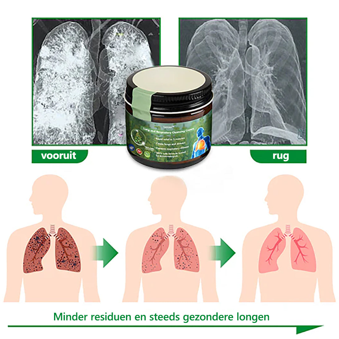 𝑳𝒆𝒓𝒄𝒆𝒂™ Mullein Lung Repair Cream - Goedgekeurd door de Nederlandse Longvereniging voor ondersteuning van de longgezondheid 🍀