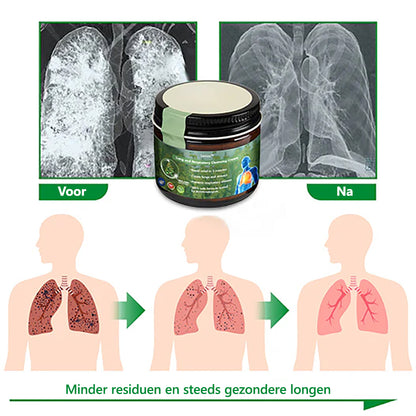 𝑳𝒆𝒓𝒄𝒆𝒂™Mullein Lung Repair Cream - goedgekeurd door de Nederlandse Thorax Vereniging om de longgezondheid te ondersteunen👨‍⚕️