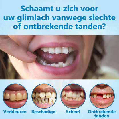 HEATWOLF® 💎Premium Geavanceerd Op Maat Gemaakt Volledig Kunstgebit Set💎 (⏰Tijdelijke korting, nog 30 minuten!)