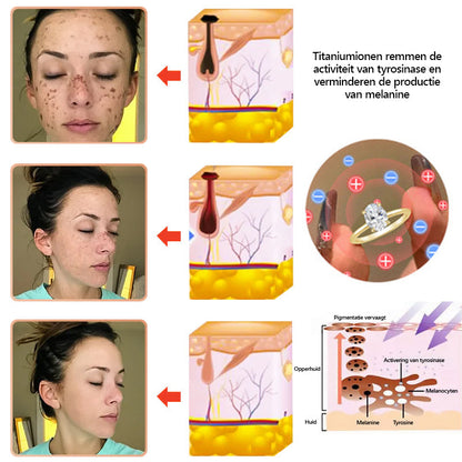 𝗖𝗭𝗧𝗜𝗖𝗟𝗘™ 𝐌𝐨𝐢𝐬𝐬𝐚𝐧𝐢𝐭𝐞 𝐃𝐢𝐚𝐦𝐚𝐧𝐭𝐞𝐧 𝐑𝐢𝐧𝐠 𝐦𝐞𝐭 𝐌𝐚𝐠𝐧𝐞𝐭𝐢𝐬𝐜𝐡𝐞 𝐓𝐡𝐞𝐫𝐚𝐩𝐢𝐞🔥(Ontgrendel je ideale lichaam en help je gemakkelijk af te vallen)🎁