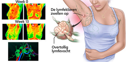 CZTICLE™ Star Moon Magnetic Therapy Afslankketting 💟 (Exclusieve afslankketting, gemakkelijk afvallen)